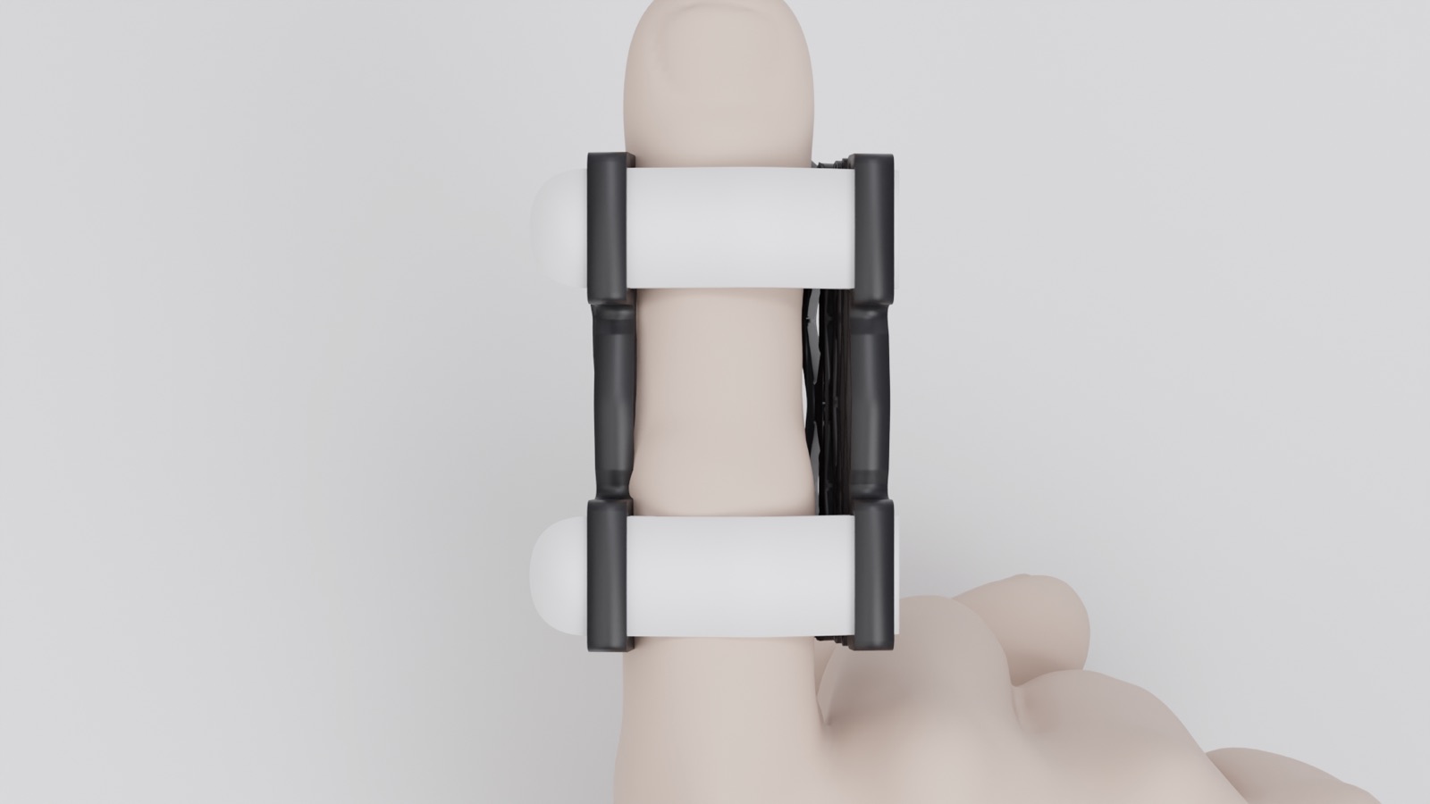 Top view of a Struxa splint worn on a hand