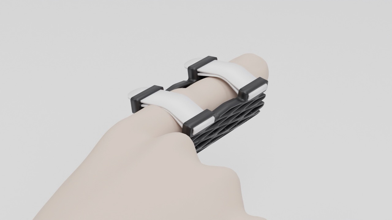 A hand easing into a Struxa finger splint