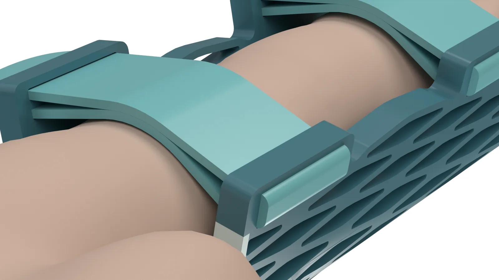 Macro view of an open-lattice Struxa splint worn on a finger, with air gaps visible between the lattice struts